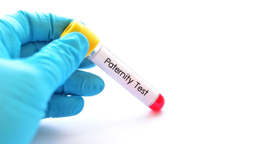 DNA test | Paternity Test